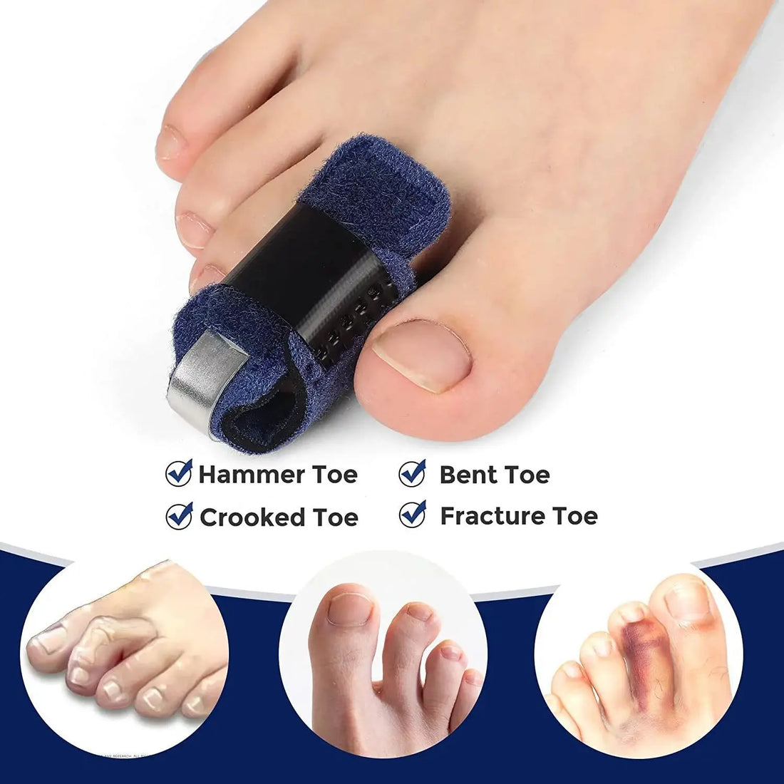 ToeAlign™ Hammer Toe Corrector – Orthotic Splints & Wraps for Toe Alignment